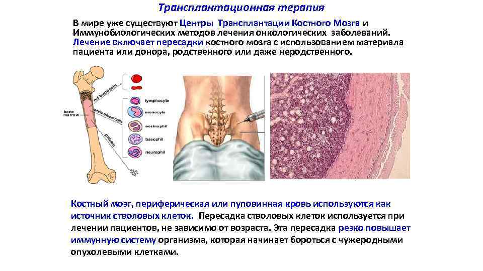 Трансплантационная терапия В мире уже существуют Центры Трансплантации Костного Мозга и Иммунобиологических методов лечения