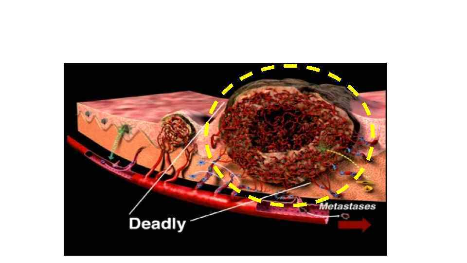 How cancer becomes dangerous YEARS… Harmless 