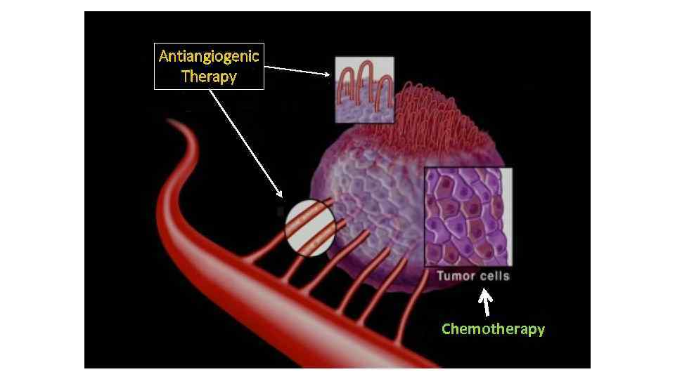 Antiangiogenic Therapy Chemotherapy 