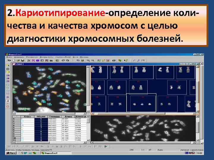 2. Кариотипирование-определение количества и качества хромосом с целью диагностики хромосомных болезней. 