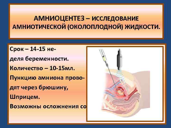 АМНИОЦЕНТЕЗ – ИССЛЕДОВАНИЕ АМНИОТИЧЕСКОЙ (ОКОЛОПЛОДНОЙ) ЖИДКОСТИ. Срок – 14 -15 неделя беременности. Количество –