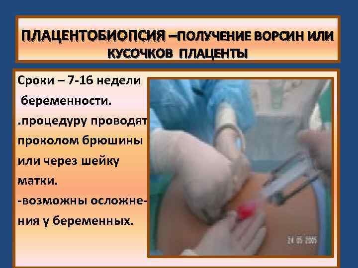 ПЛАЦЕНТОБИОПСИЯ –ПОЛУЧЕНИЕ ВОРСИН ИЛИ КУСОЧКОВ ПЛАЦЕНТЫ Сроки – 7 -16 недели беременности. . процедуру