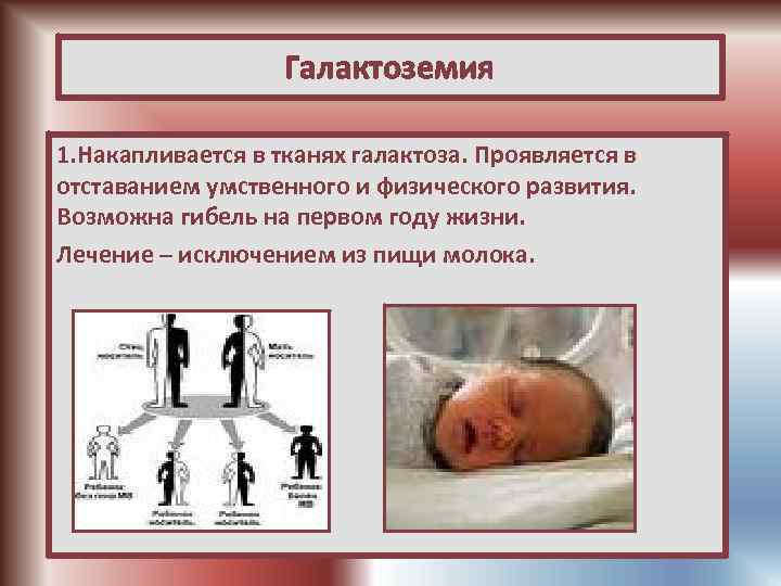 Галактоземия презентация по педиатрии