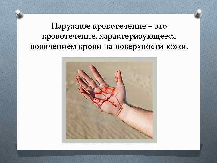 Наружное кровотечение – это кровотечение, характеризующееся появлением крови на поверхности кожи. 
