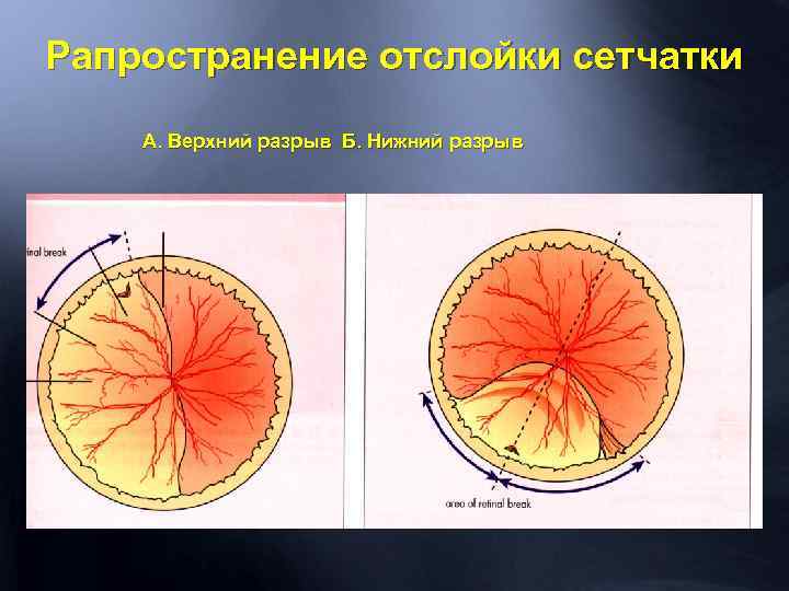 Глазное дно схема