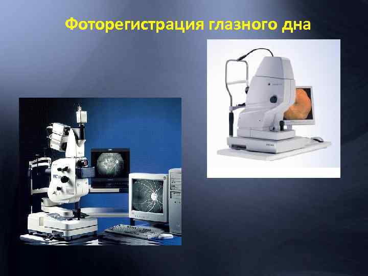 Фоторегистрация глазного дна 