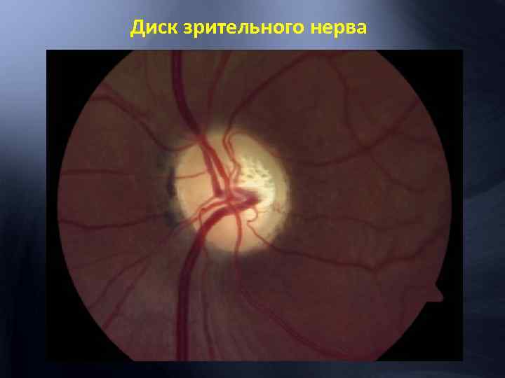 Диск зрительного нерва 