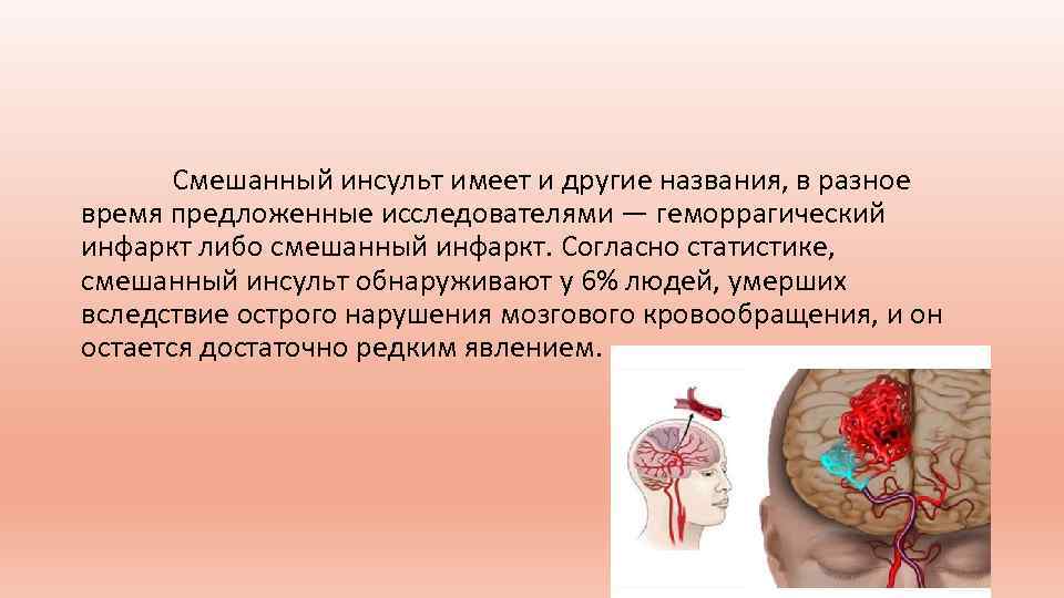 Инфаркт головного мозга последствия у мужчин