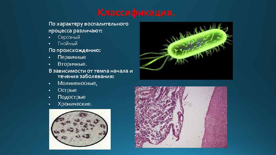 Классификация. По характеру воспалительного процесса различают: § § Серозный Гнойный По происхождению: § Первичные