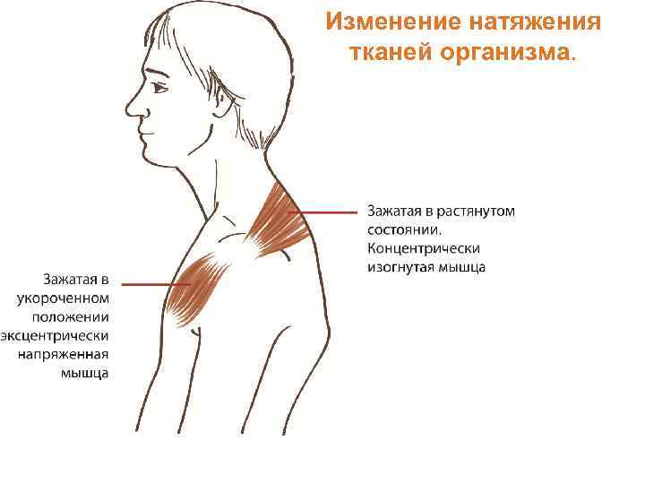 Изменение натяжения тканей организма. 