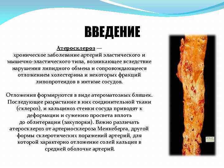 ВВЕДЕНИЕ Атеросклероз — хроническое заболевание артерий эластического и мышечно-эластического типа, возникающее вследствие нарушения липидного