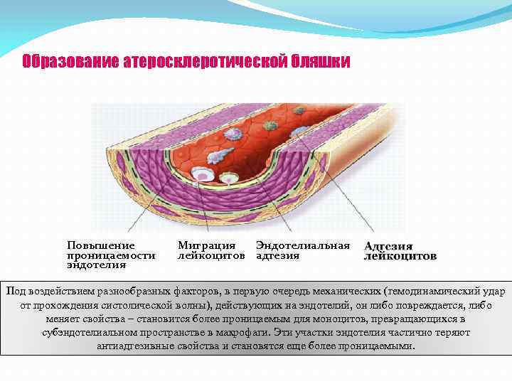 Образование атеросклеротической бляшки Повышение проницаемости эндотелия Миграция Эндотелиальная лейкоцитов адгезия Под воздействием разнообразных факторов,