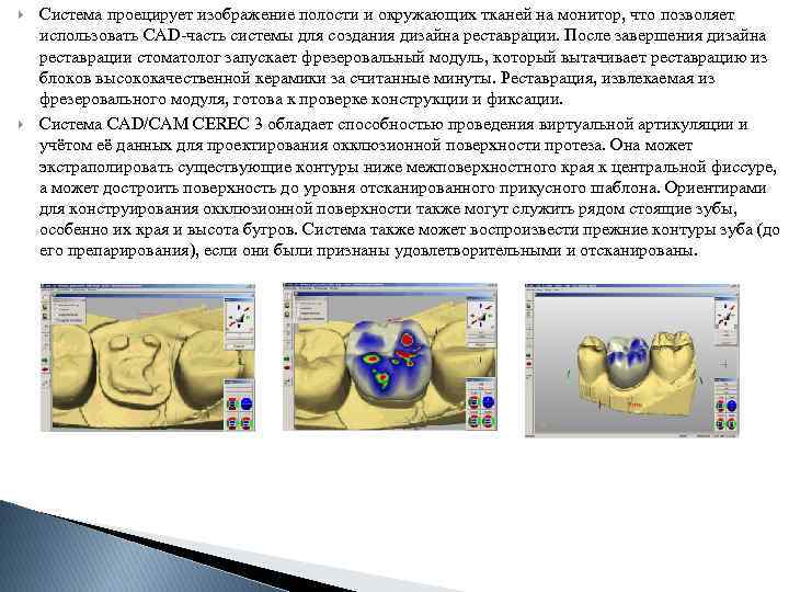  Система проецирует изображение полости и окружающих тканей на монитор, что позволяет использовать CAD-часть