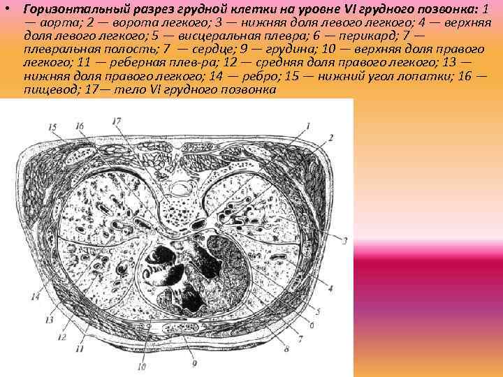  • Горизонтальный разрез грудной клетки на уровне VI грудного позвонка: 1 — аорта;