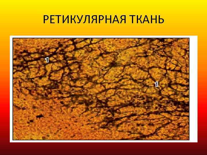 РЕТИКУЛЯРНАЯ ТКАНЬ 