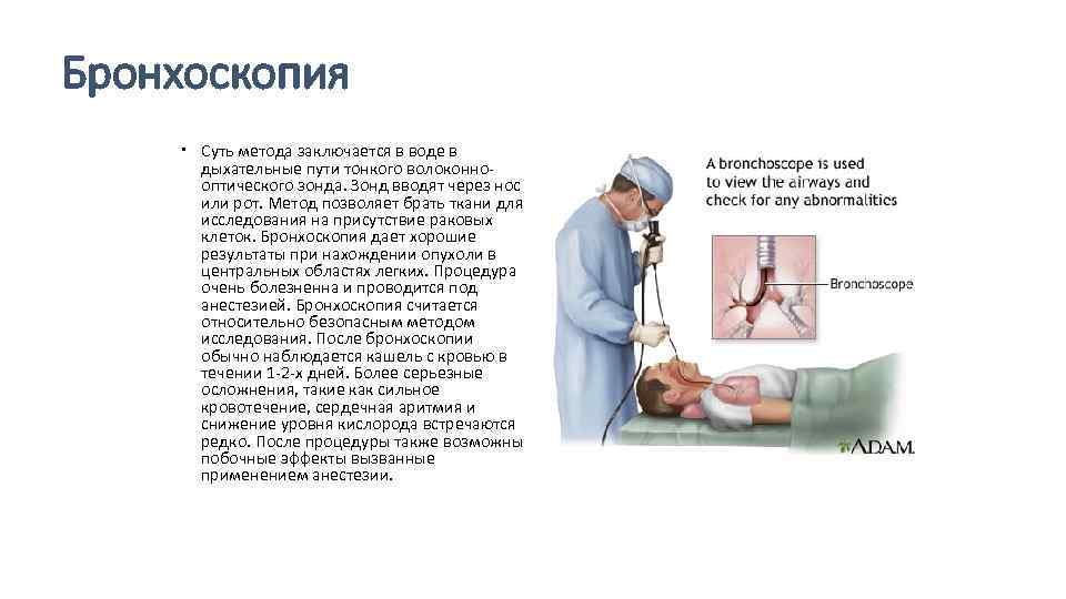 Бронхоскопия в москве