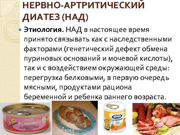 НЕРВНО-АРТРИТИЧЕСКИЙ ДИАТЕЗ (НАД) Этиология. НАД в настоящее время принято связывать как с наследственными факторами