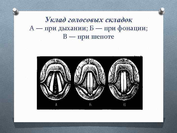 Уклад голосовых складок А — при дыхании; Б — при фонации; В — при