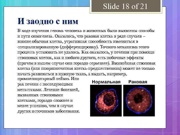 Slide 18 of 21 И заодно с ним В ходе изучения генома человека и