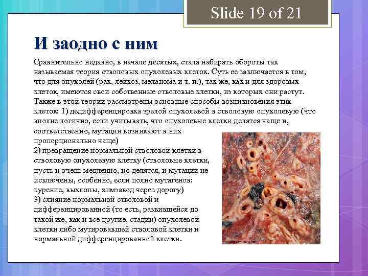 Slide 19 of 21 И заодно с ним Сравнительно недавно, в начале десятых, стала