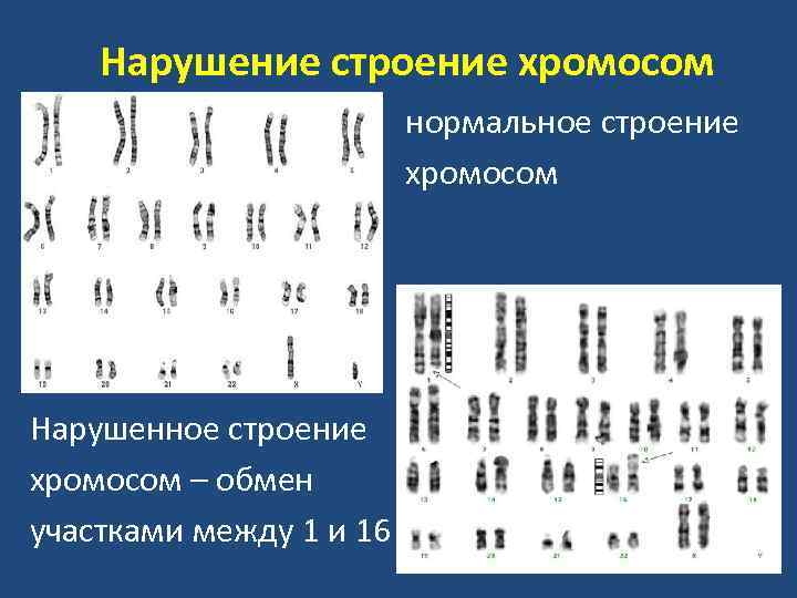 Изменение строения хромосом