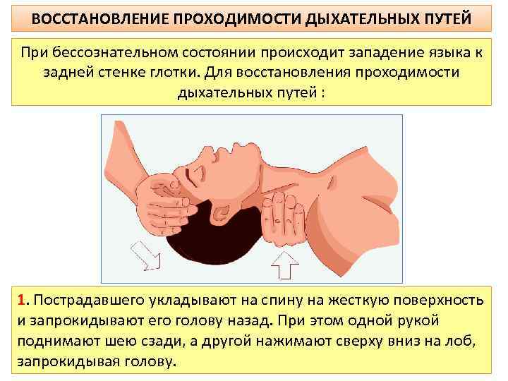 ВОССТАНОВЛЕНИЕ ПРОХОДИМОСТИ ДЫХАТЕЛЬНЫХ ПУТЕЙ При бессознательном состоянии происходит западение языка к задней стенке глотки.