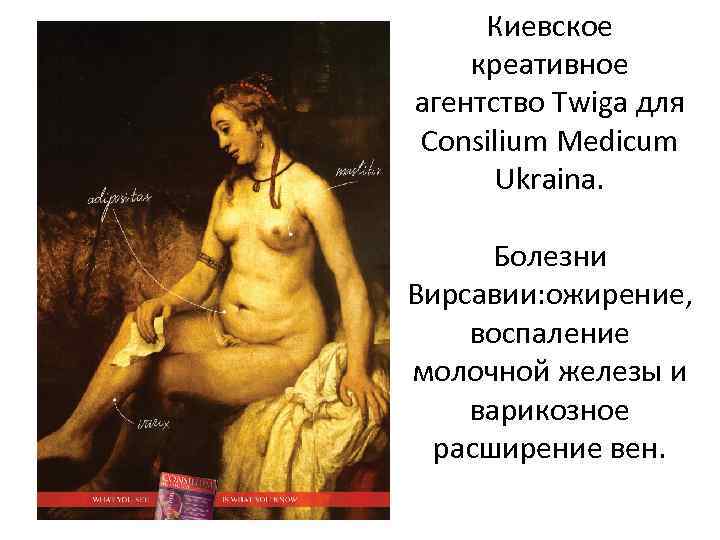 Киевское креативное агентство Twiga для Consilium Medicum Ukraina. Болезни Вирсавии: ожирение, воспаление молочной железы