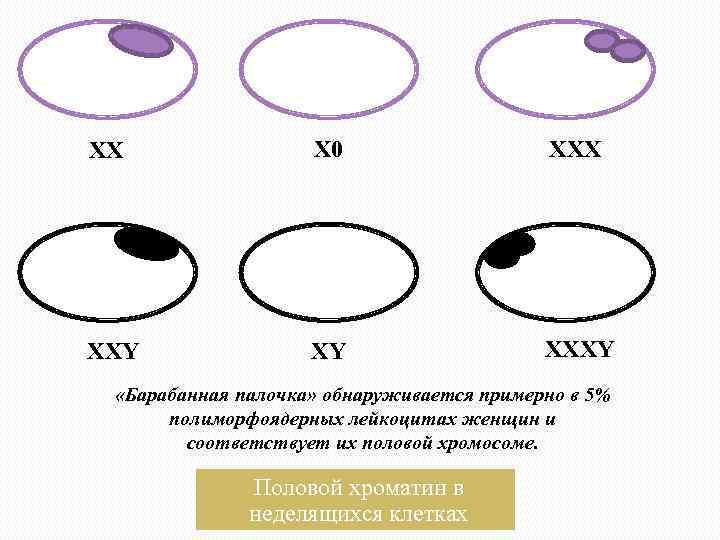 XX X 0 XXX XXY XY XXXY «Барабанная палочка» обнаруживается примерно в 5% полиморфоядерных