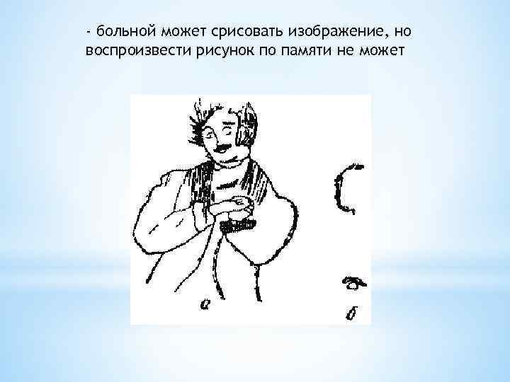 - больной может срисовать изображение, но воспроизвести рисунок по памяти не может 