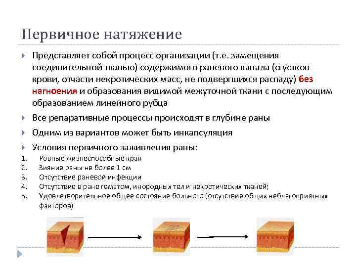 Первичное натяжение 1. 2. 3. 4. 5. Представляет собой процесс организации (т. е. замещения