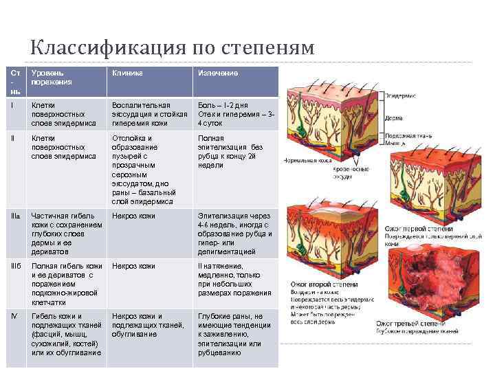 Классификация по степеням Ст нь Уровень поражения Клиника Излечение I Клетки поверхностных слоев эпидермиса