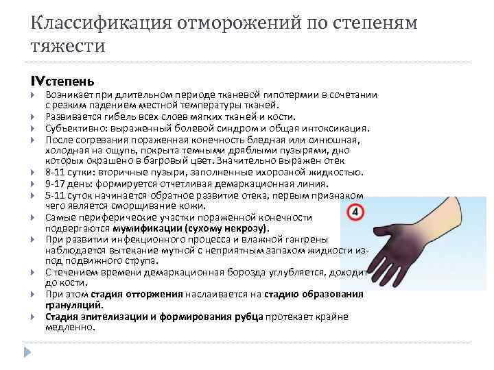 Классификация отморожений по степеням тяжести IVстепень Возникает при длительном периоде тканевой гипотермии в сочетании