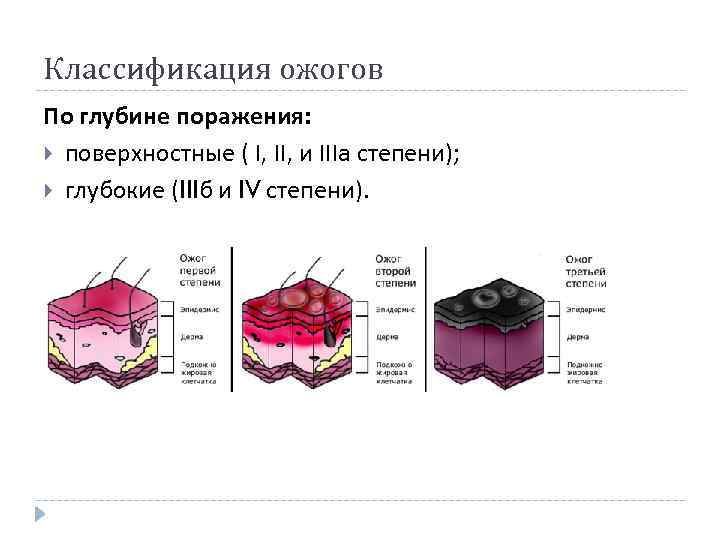 Классификация ожогов По глубине поражения: поверхностные ( I, II, и IIIа степени); глубокие (IIIб