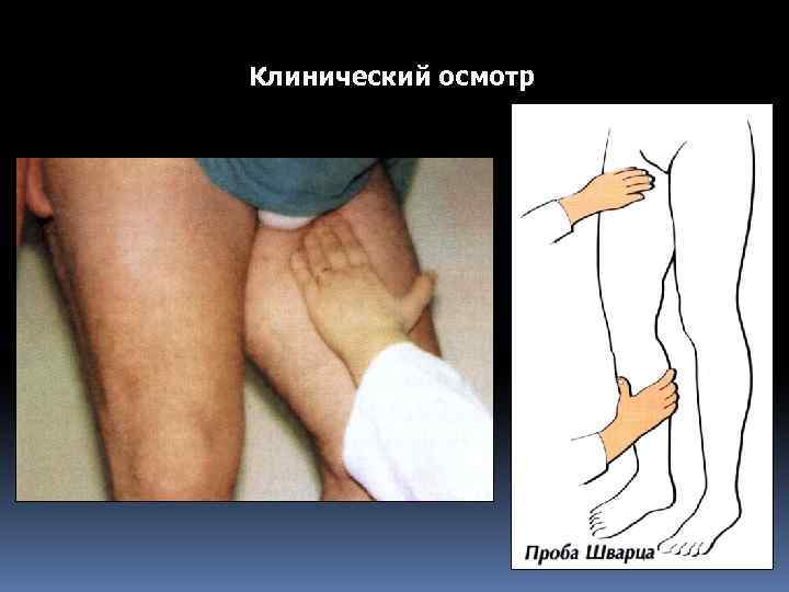 Клинический осмотр 
