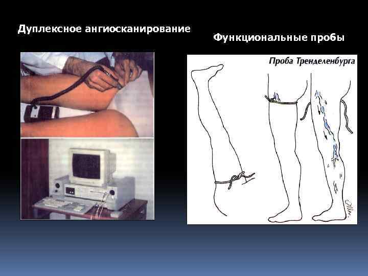 Дуплексное ангиосканирование Функциональные пробы 