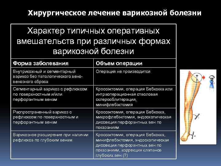 Хирургическое лечение варикозной болезни Характер типичных оперативных вмешательств при различных формах варикозной болезни Форма