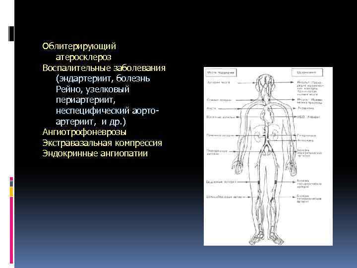 Облитерирующий атеросклероз Воспалительные заболевания (эндартериит, болезнь Рейно, узелковый периартериит, неспецифический аортоартериит, и др. )