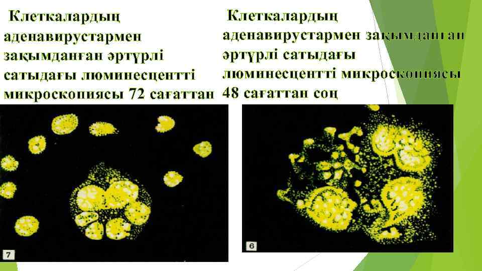  Клеткалардың аденавирустармен зақымданған аденавирустармен әртүрлі сатыдағы зақымданған әртүрлі сатыдағы люминесцентті микроскопиясы 72 сағаттан