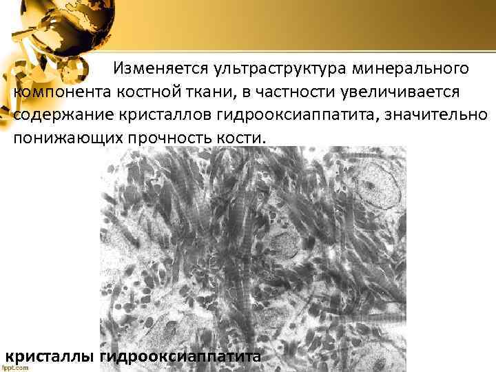  Изменяется ультраструктура минерального компонента костной ткани, в частности увеличивается содержание кристаллов гидрооксиаппатита, значительно