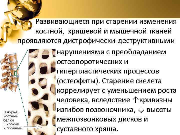 Костно мышечная ткань. Изменение костной ткани. Изменения при старении. Старение позвоночника. Возрастные изменения костной ткани.