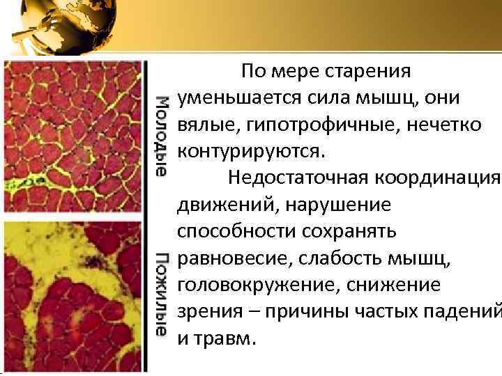  По мере старения уменьшается сила мышц, они вялые, гипотрофичные, нечетко контурируются. Недостаточная координация