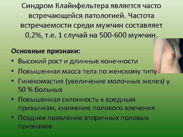 Синдром Клайнфельтера является часто встречающейся патологией. Частота встречаемости среди мужчин составляет 0, 2%, т.