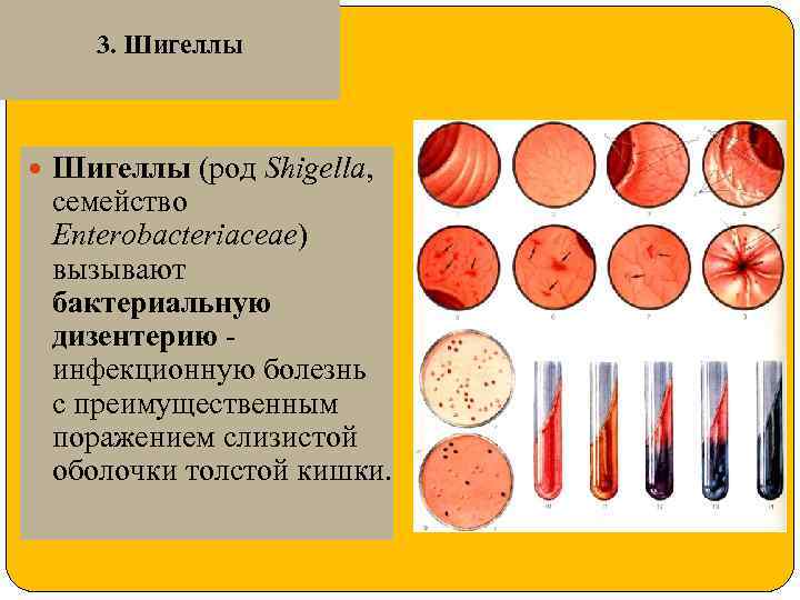 3. Шигеллы (род Shigella, семейство Enterobacteriaceae) вызывают бактериальную дизентерию - инфекционную болезнь с преимущественным