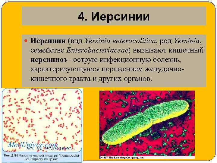 Заболевания вызываемые кишечной палочкой