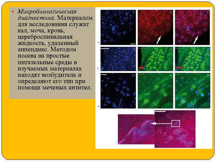  Микробиологическая диагностика. Материалом для исследования служат кал, моча, кровь, цереброспинальная жидкость, удаленный аппендикс.
