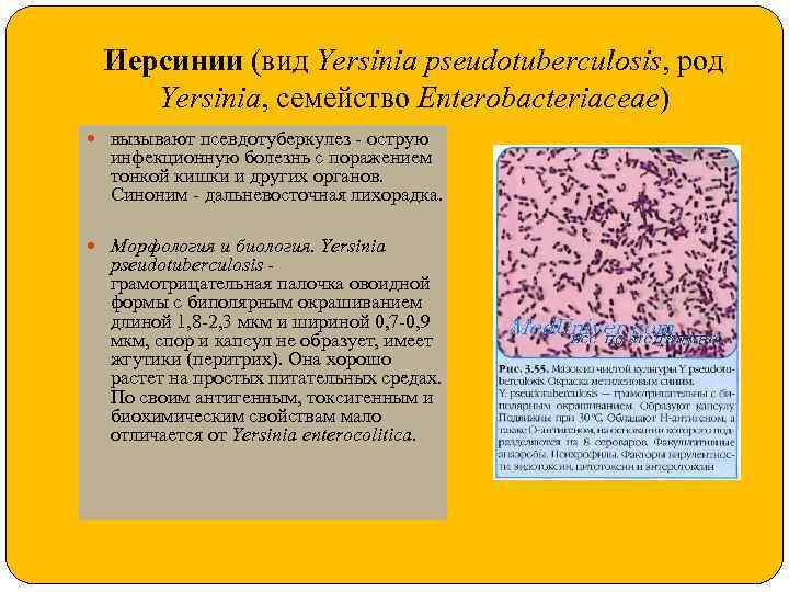 Иерсинии (вид Yersinia pseudotuberculosis, род Yersinia, семейство Enterobacteriaceae) вызывают псевдотуберкулез - острую инфекционную болезнь