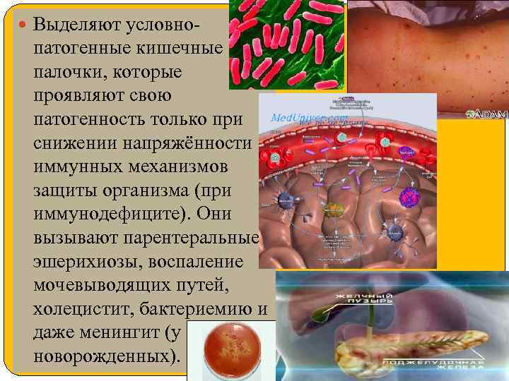  Выделяют условно- патогенные кишечные палочки, которые проявляют свою патогенность только при снижении напряжённости