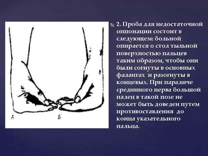  2. Проба для недостаточной оппонации состоит в следующем: больной опирается о стол тыльной