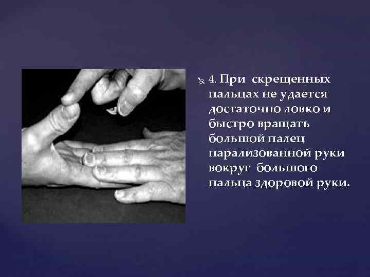  4. При скрещенных пальцах не удается достаточно ловко и быстро вращать большой палец