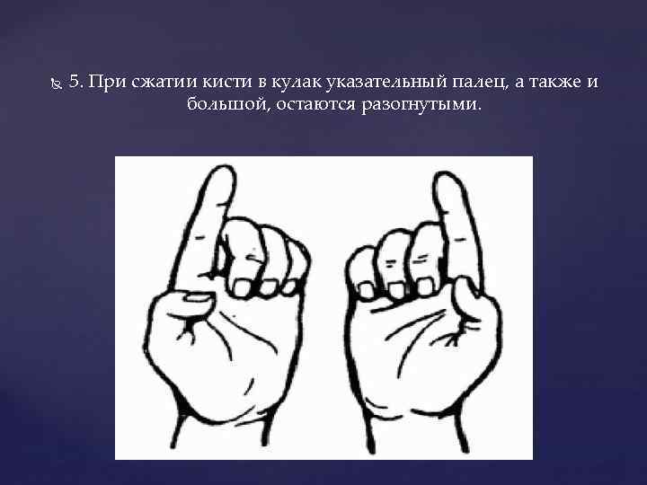  5. При сжатии кисти в кулак указательный палец, а также и большой, остаются